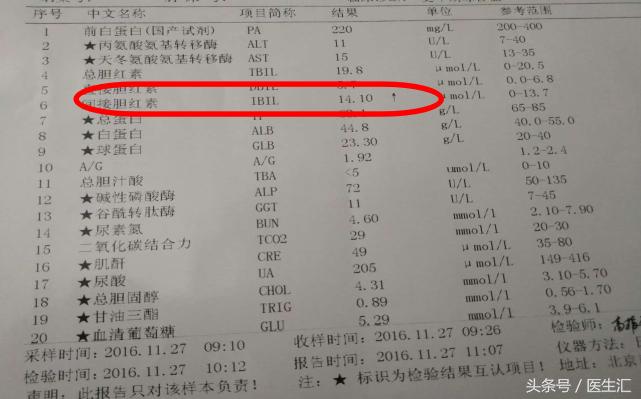 如何判定更年期综合征,更年期主要看哪个指标