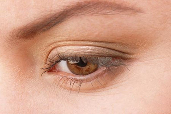 内双割双眼皮变成三眼皮怎么修复,双眼皮修复三次会有什么后果