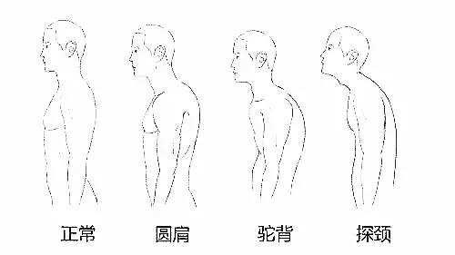 腰背不舒服一招解决,腰背不舒服怎么拉伸