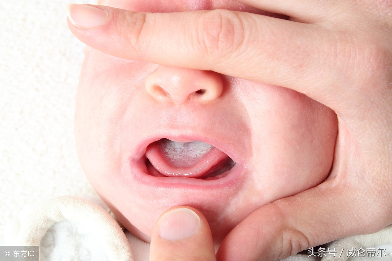 宝宝内火太盛,如何判断宝宝内火重