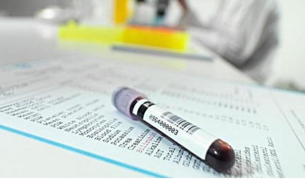 婚检查到重大疾病男方可以起诉么,婚检查出疾病会通知配偶吗