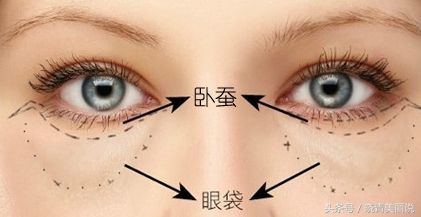 卧蚕会变成眼袋吗,卧蚕是怎么变成眼袋的