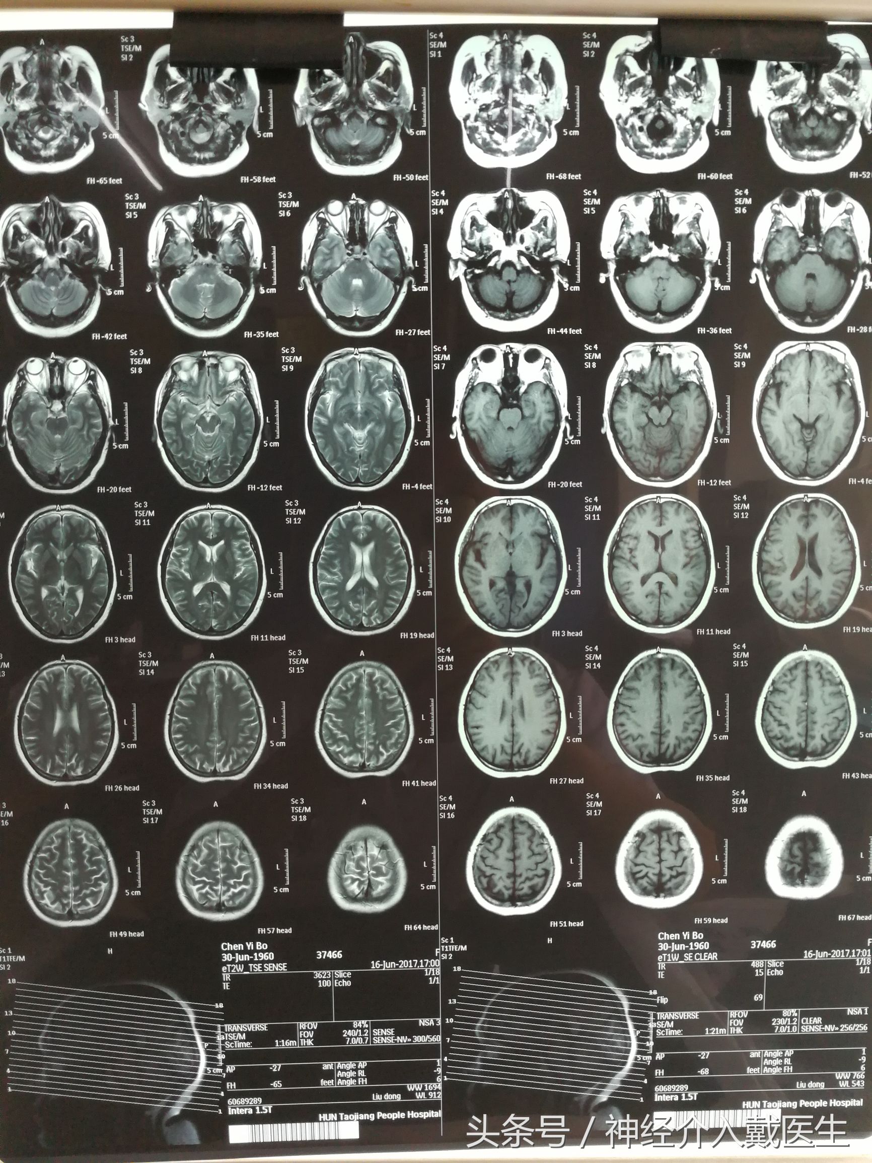 经常晕倒什么原因,经常晕倒是什么原因