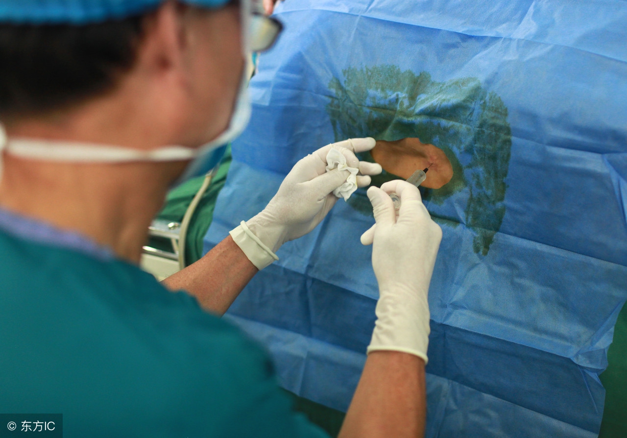 女性做剖腹产手术有什么风险？