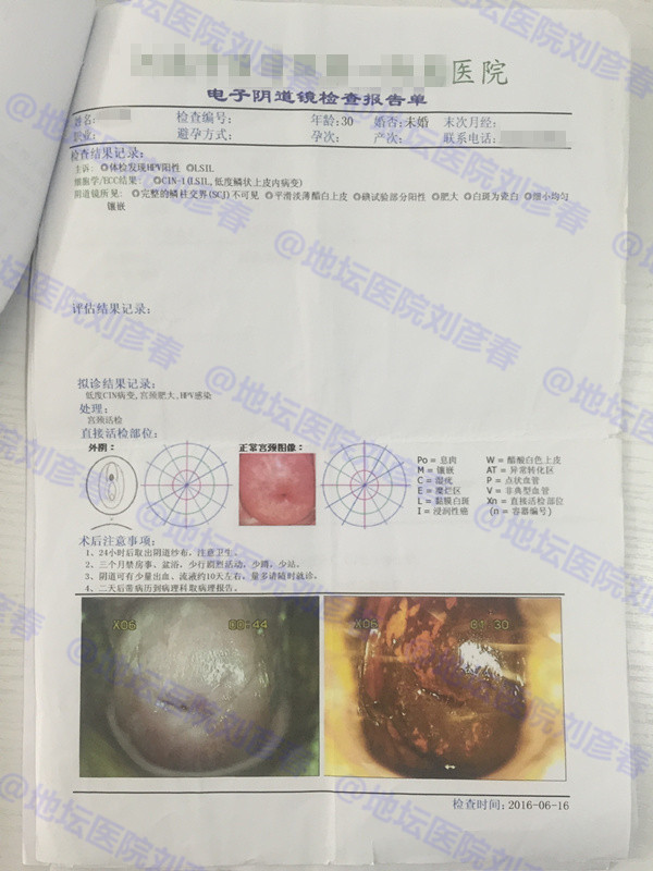 病例分享——如何提高HPV的清除率？