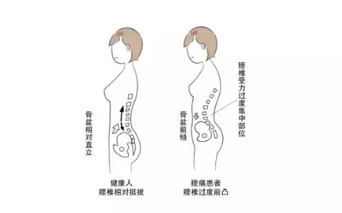 高低肩长短腿矫正视频,高低肩腿长短不一纠正训练动作