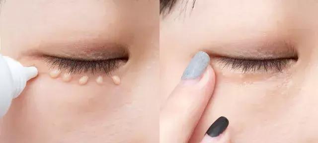 不用针挑刺,不用针挑刺还有什么办法能挑