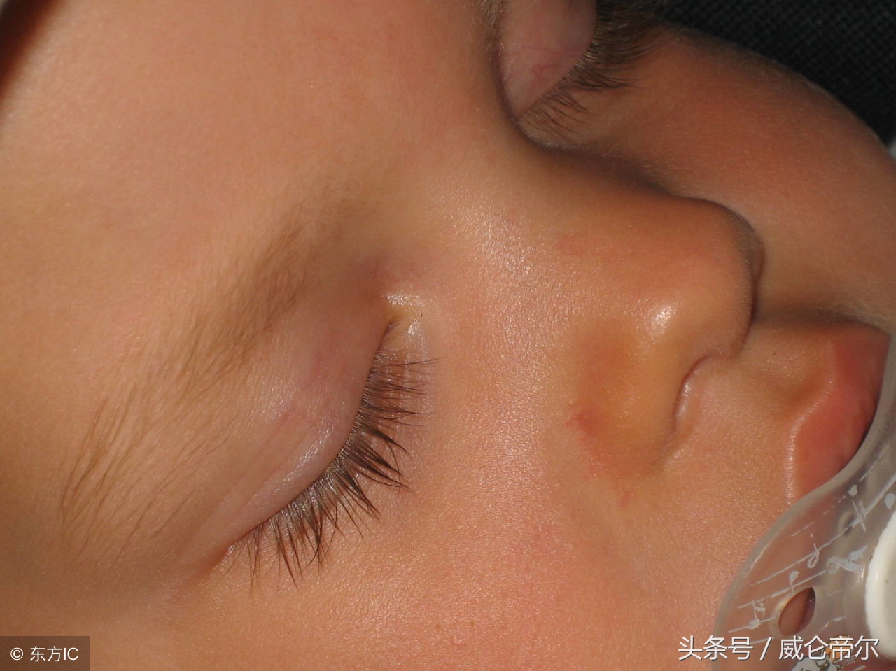 宝宝内火太盛,如何判断宝宝内火重