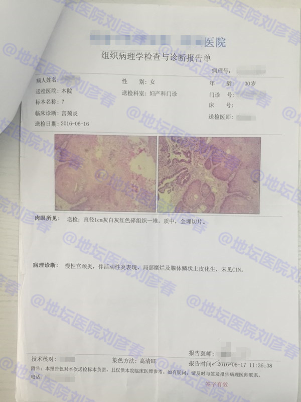 病例分享——如何提高HPV的清除率？