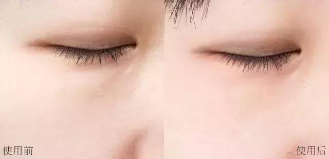 不用针挑刺,不用针挑刺还有什么办法能挑