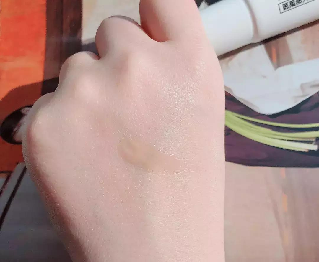 不用针挑刺,不用针挑刺还有什么办法能挑