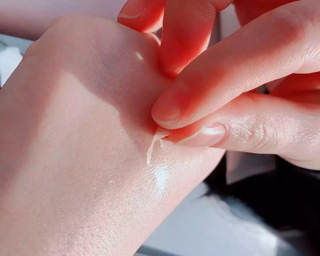 不用针挑刺,不用针挑刺还有什么办法能挑