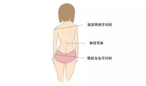 高低肩长短腿矫正视频,高低肩腿长短不一纠正训练动作