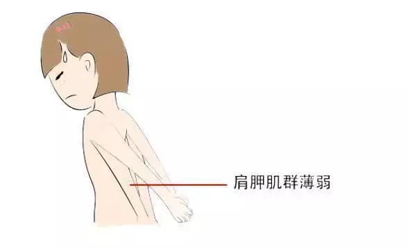 高低肩长短腿矫正视频,高低肩腿长短不一纠正训练动作