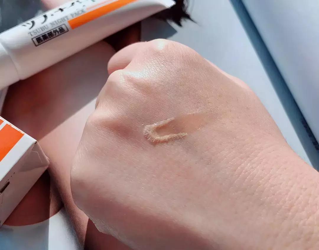 不用针挑刺,不用针挑刺还有什么办法能挑