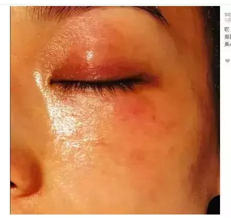 舒淇不垮脸怎么保养的,舒淇的脸容易敏感吗