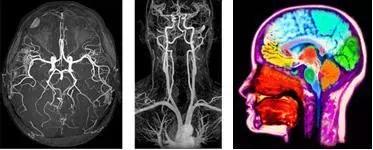 大学生做飞秒手术后濒临死亡,大学生救死扶伤后死亡