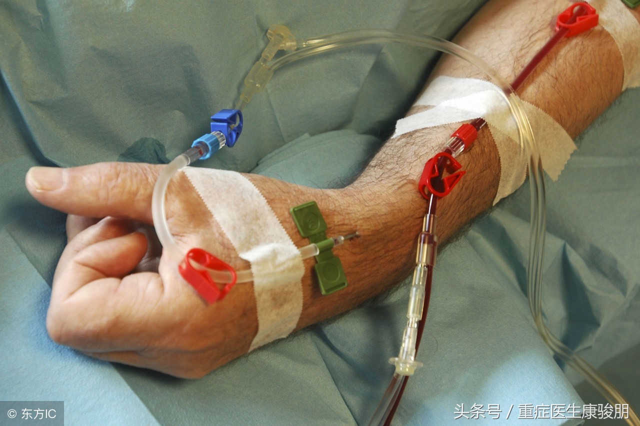 血液净化和血浆置换,血液净化相关知识讲课