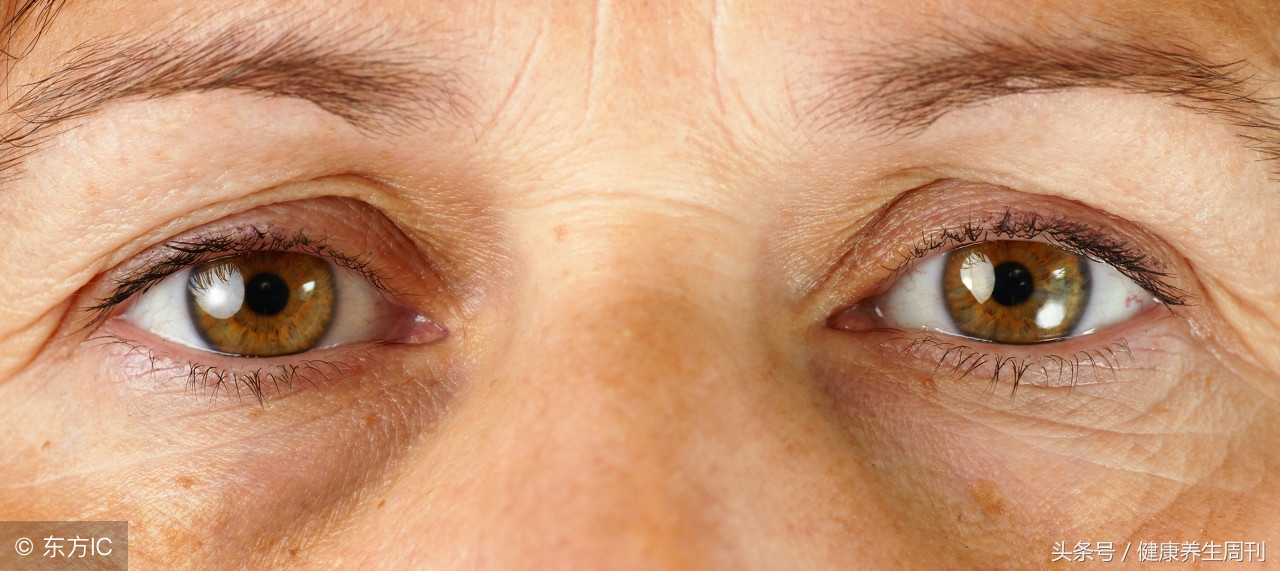 黑眼圈怎么消除最快方法,小孩黑眼圈怎么消除最有效