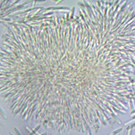 辣椒炭疽病的病原形态,辣椒炭疽病的病症为点状物