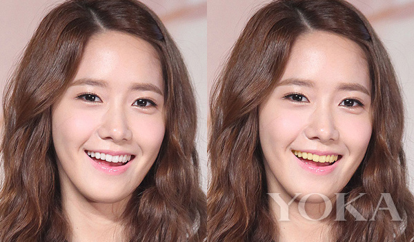 大变脸原来整牙才是高颜值,女星整牙都是越整越美