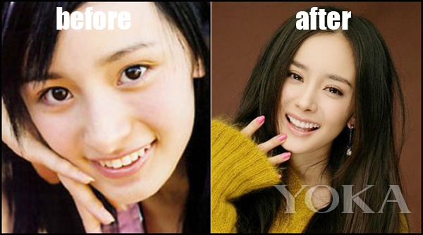 大变脸原来整牙才是高颜值,女星整牙都是越整越美