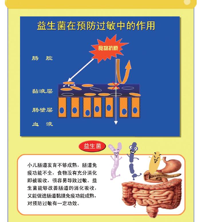 湿疹治疗过程中需要注意什么,宝宝湿疹大作战图文