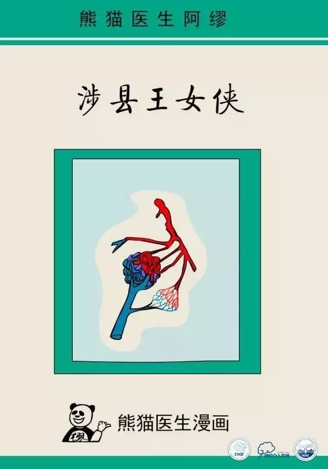 熊猫医生阿缪：脑动静脉畸形怎么破