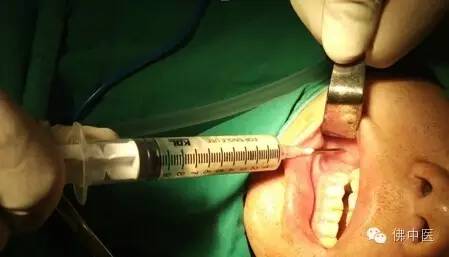 大肚婆注意事项,大肚婆要注意哪些问题