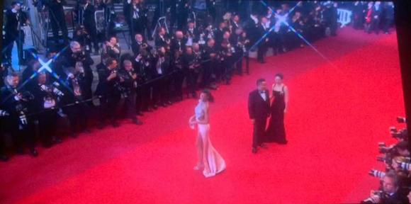 田永成整形有多牛,田永成眼部整形