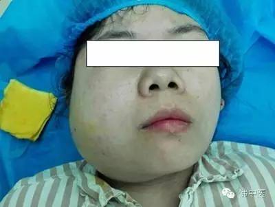 大肚婆注意事项,大肚婆要注意哪些问题