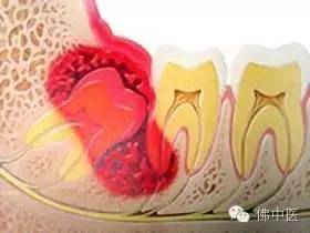 大肚婆注意事项,大肚婆要注意哪些问题