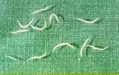 儿童寄生虫病怎么治疗效果好,儿童寄生虫怎么消灭最快