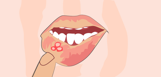 当狗舔你的嘴时会发生什么,狗喜欢舔你的嘴是因为什么