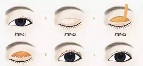 做双眼皮手术为什么要忌烟酒,割了双眼皮但是当地饮食偏辣