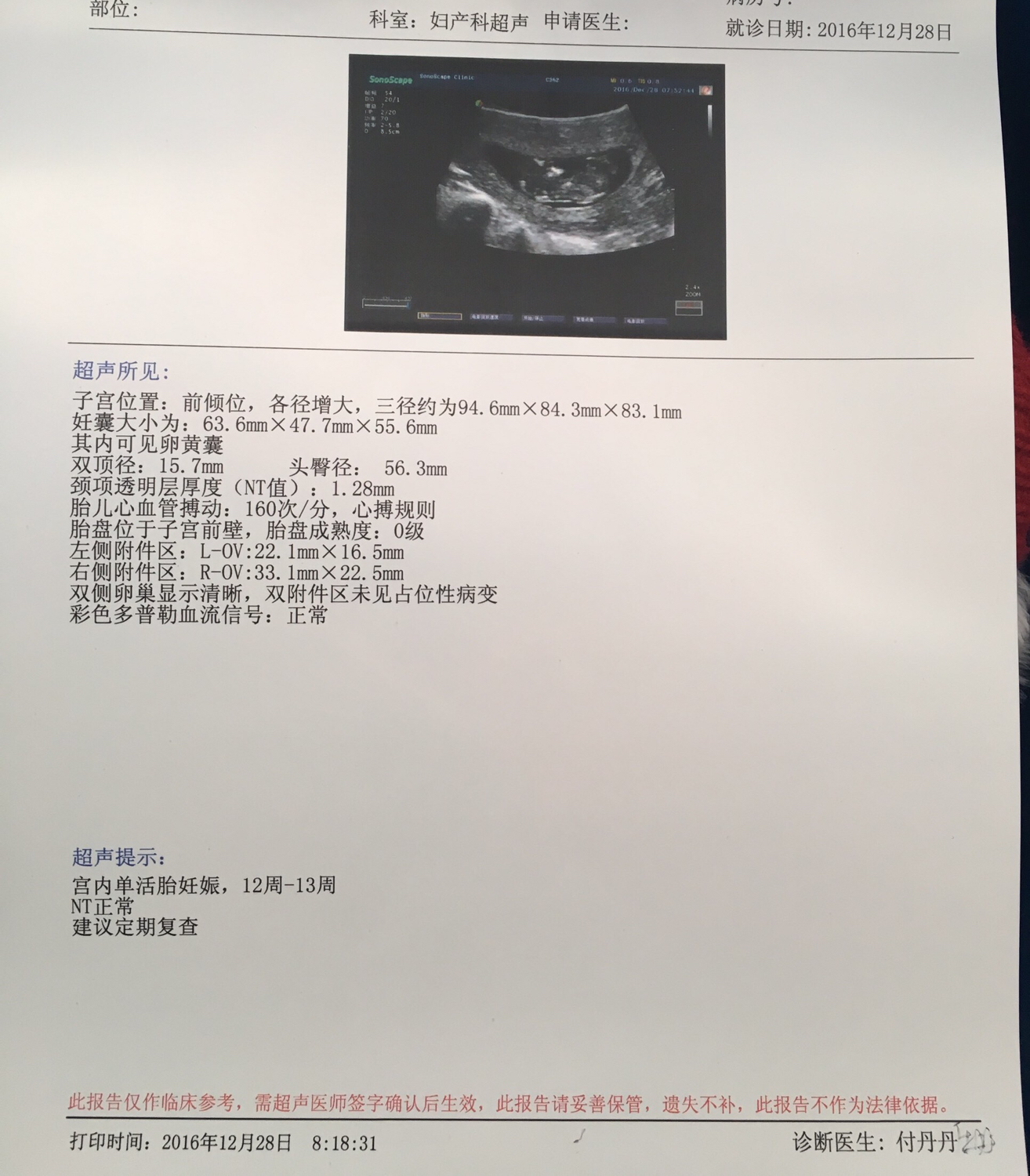 孕期nt检查能推后吗,孕期nt检查能吃饭吗