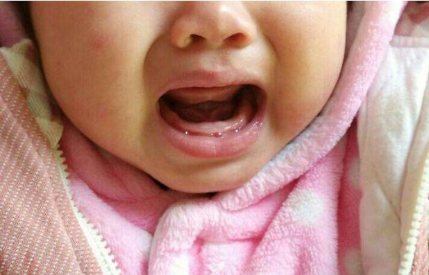 6个月宝宝长牙了需要注意什么,6个月宝宝长牙在侧面怎么回事