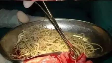 该打虫子的表现,该打虫了是什么意思