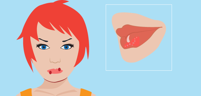 当狗舔你的嘴时会发生什么,狗喜欢舔你的嘴是因为什么