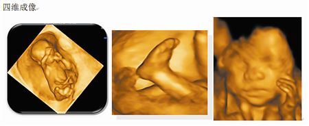 孕妈怀孕后羊水是怎样形成的,孕妈妈收藏