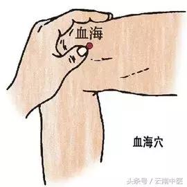 来月经痛经能扎针灸治疗吗,痛经针灸三阴交是补还是泻