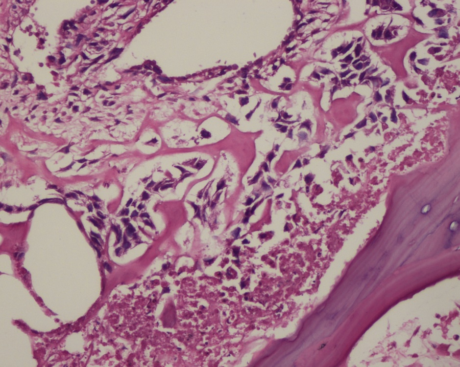 左胯骨内侧隐痛要当心,左肋骨隐隐痛要当心了