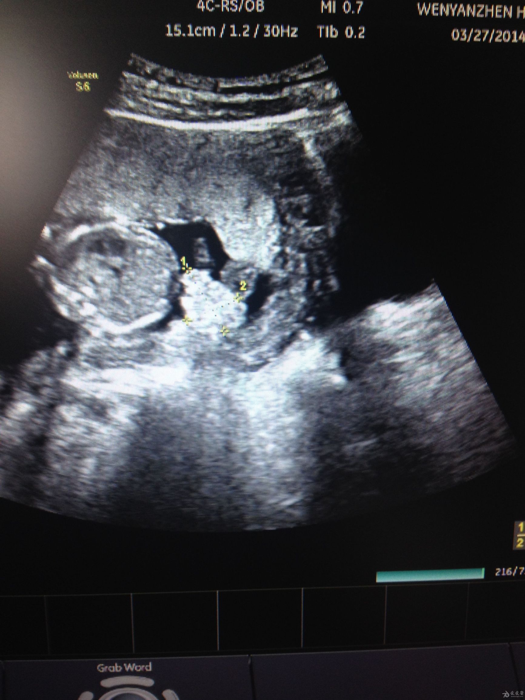 孕妈怀孕后羊水是怎样形成的,孕妈妈收藏