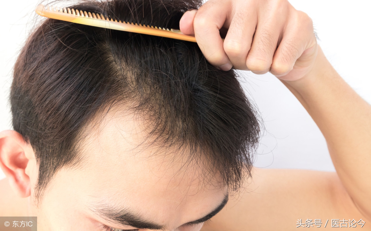肾虚脱发肾好了会不会长出来,肾虚导致的脱发有什么特点