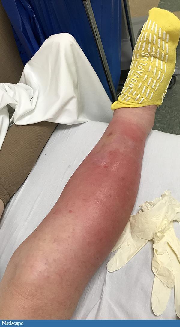 抗菌素的合理使用指南,国外抗菌药的合理使用