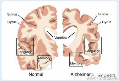 dha能让胎儿头大吗,dha能让人变聪明吗