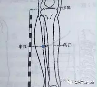 中医减肥降脂化痰祛湿方剂,祛湿化痰减肥药方