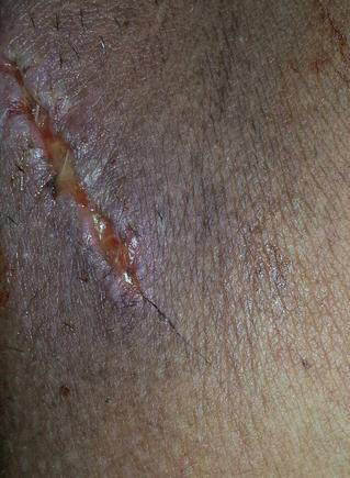 生孩子，是不是都要侧切？看看医生怎么说的