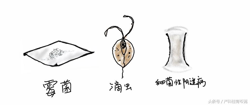 顽固性外阴瘙痒治不好了吧,不明原因的外阴瘙痒怎么办