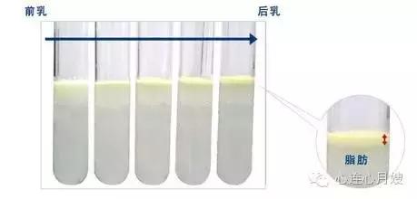 母乳性黄疸停母乳后大便颜色,母乳正常应该是什么颜色